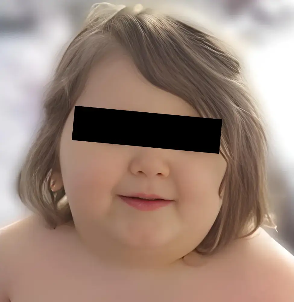 foto de Casper O’Brien, el niño que murió pesando aproximadamente 255 libras