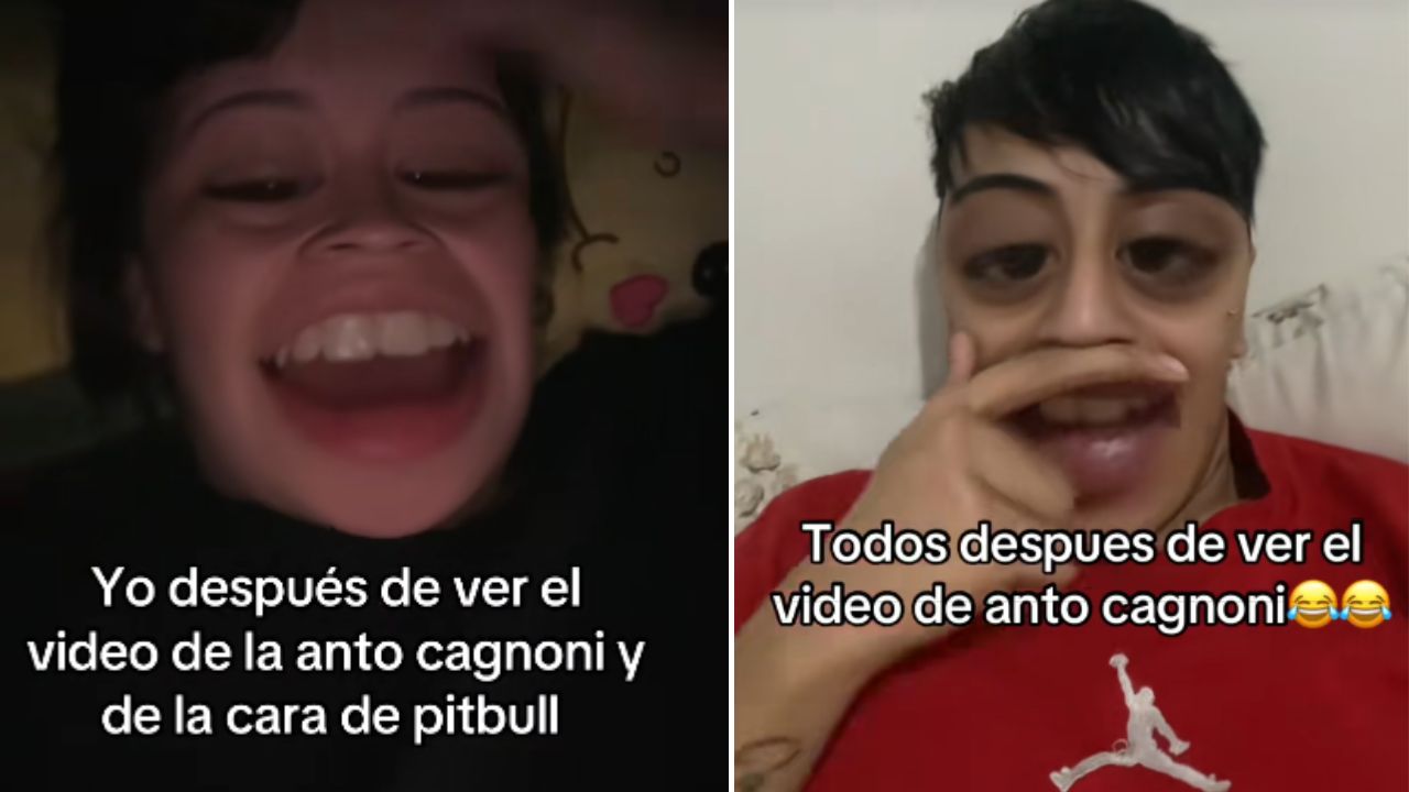 Anto Cagnoni y La cara de pitbull video filtrado