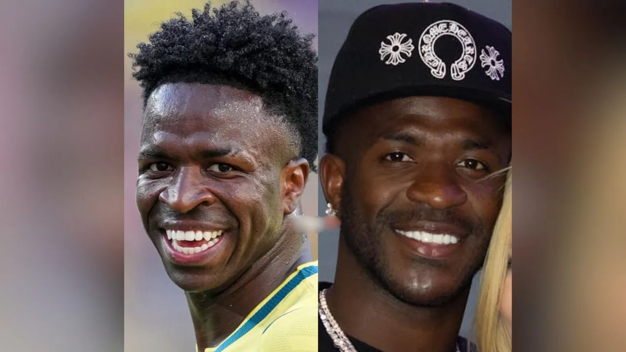 Fotografías de Vinícius Jr antes y después de la cirugía de barbilla.