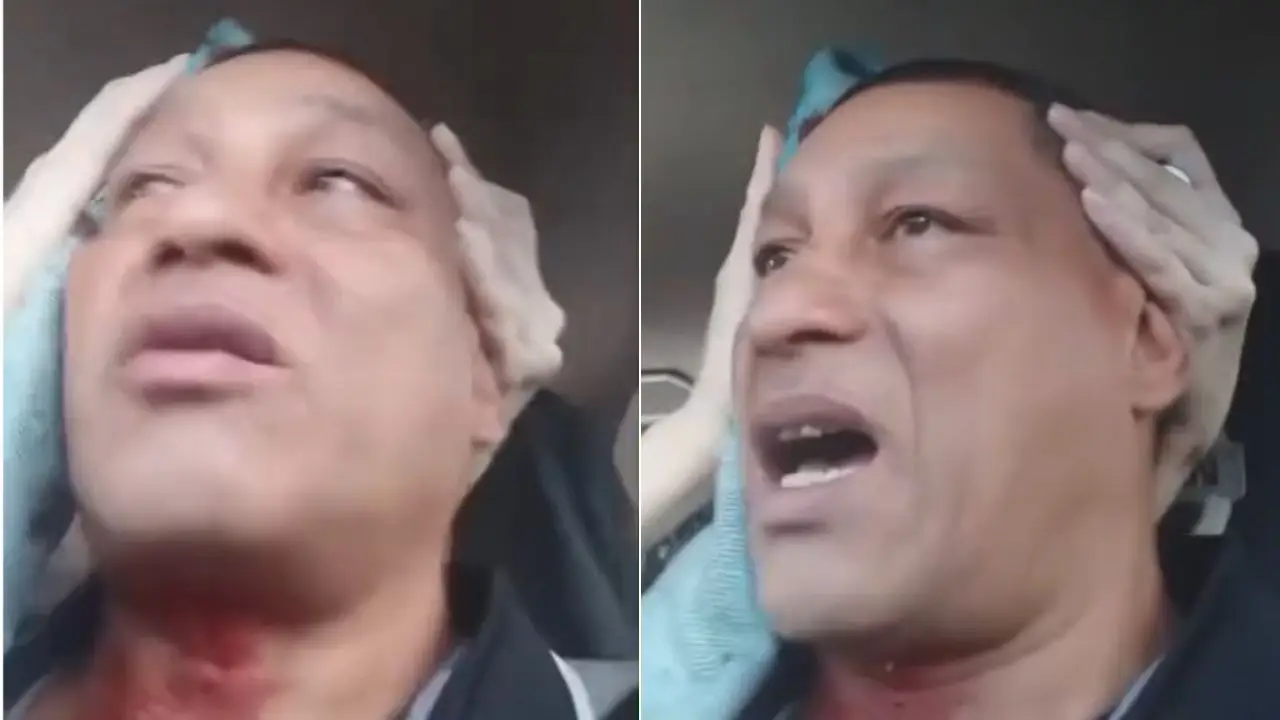 conductor sufre balazo atentado