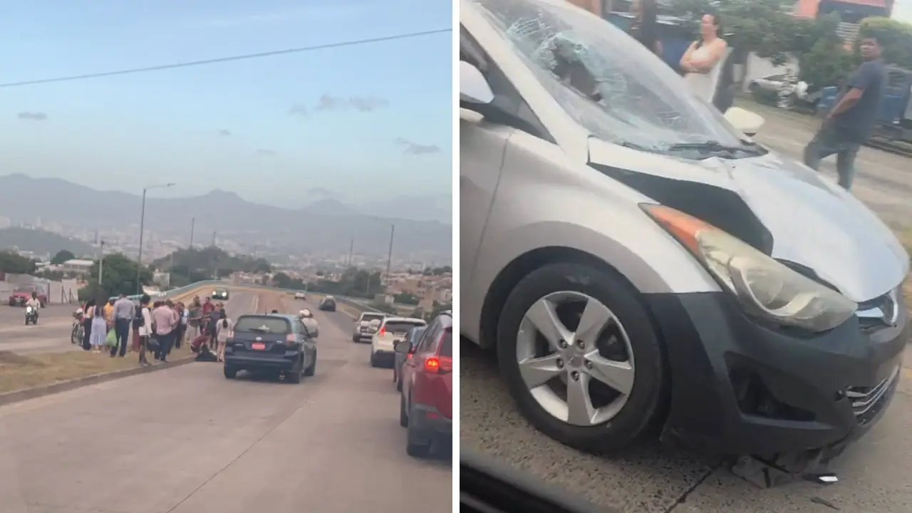 Abuelo muere tras ser embestido por un vehículo en el Anillo Periférico Imagen de Abuelo muere tras ser embestido por un vehículo en el Anillo Periférico