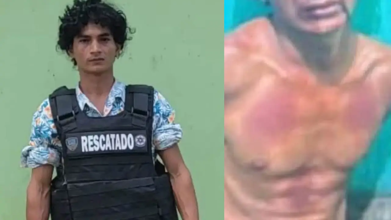 Ni era sangre ni estaba secuestrado: pasta de tomate destapó engaño por L600 mil Imagen de Ni era sangre ni estaba secuestrado: pasta de tomate destapó engaño por L600 mil