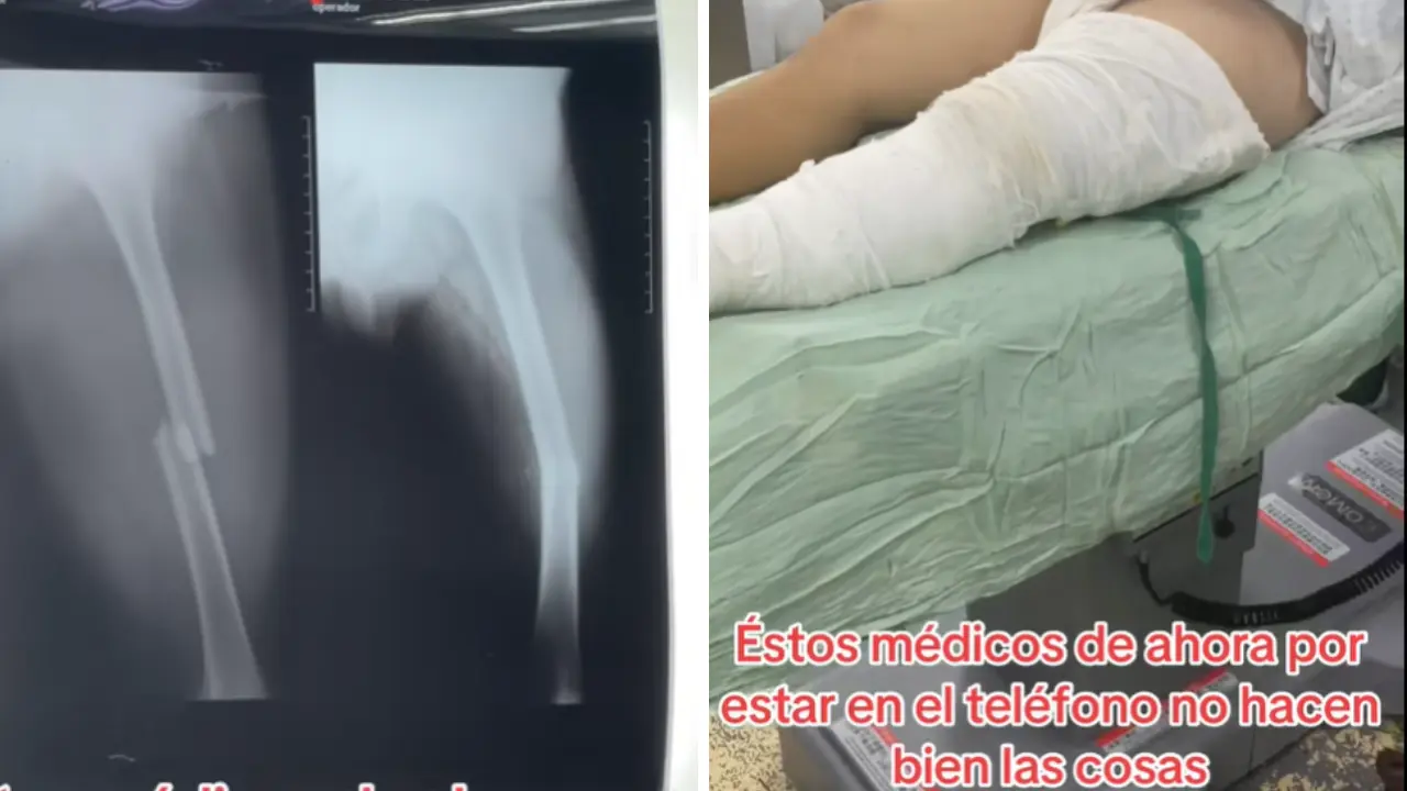 Médico denuncia mala praxis: colega puso una férula ‘como lo haría un vigilante’ Imagen de Médico denuncia mala praxis: colega puso una férula ‘como lo haría un vigilante’