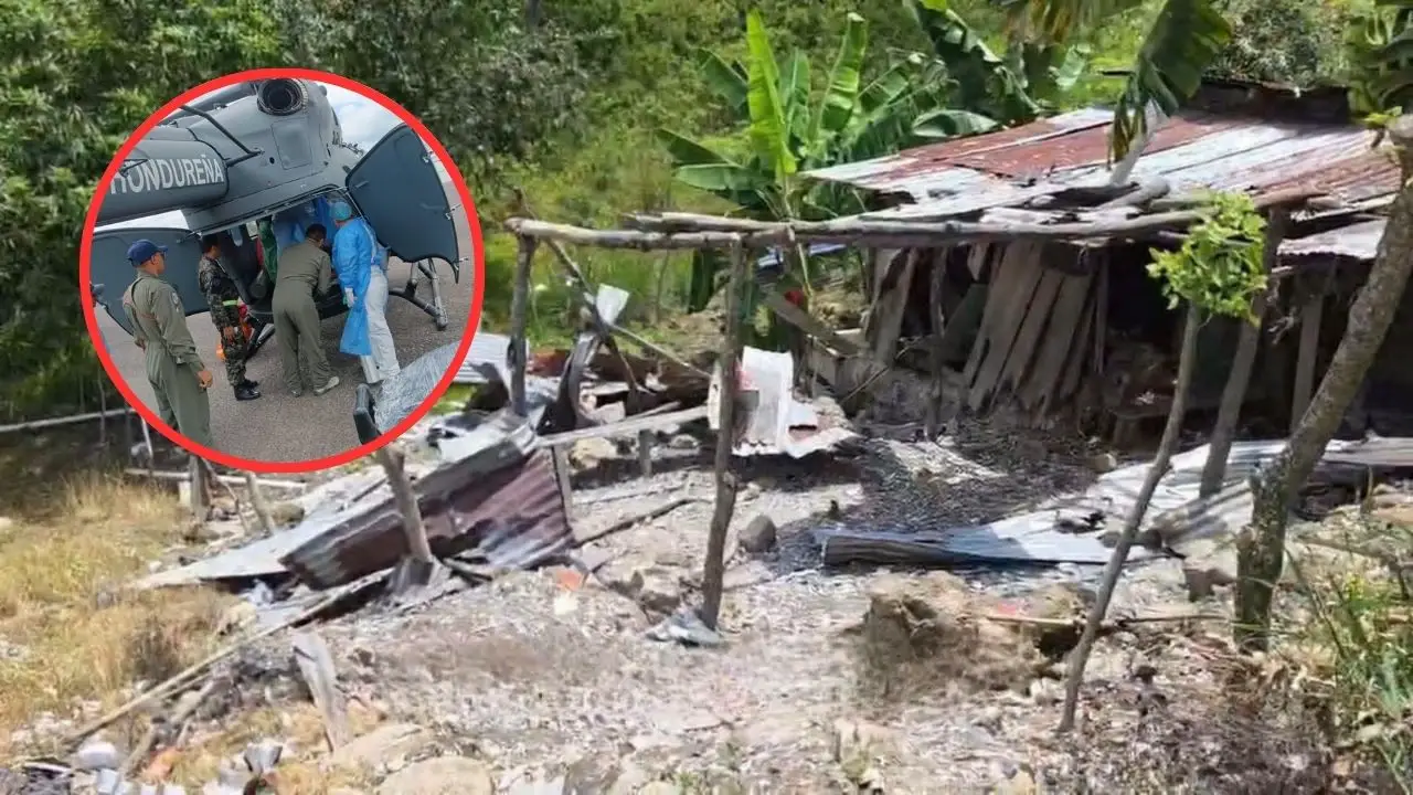 Niño de 10 años tercera víctima de explosión de cohetería en Copán Imagen de Niño de 10 años tercera víctima de explosión de cohetería en Copán