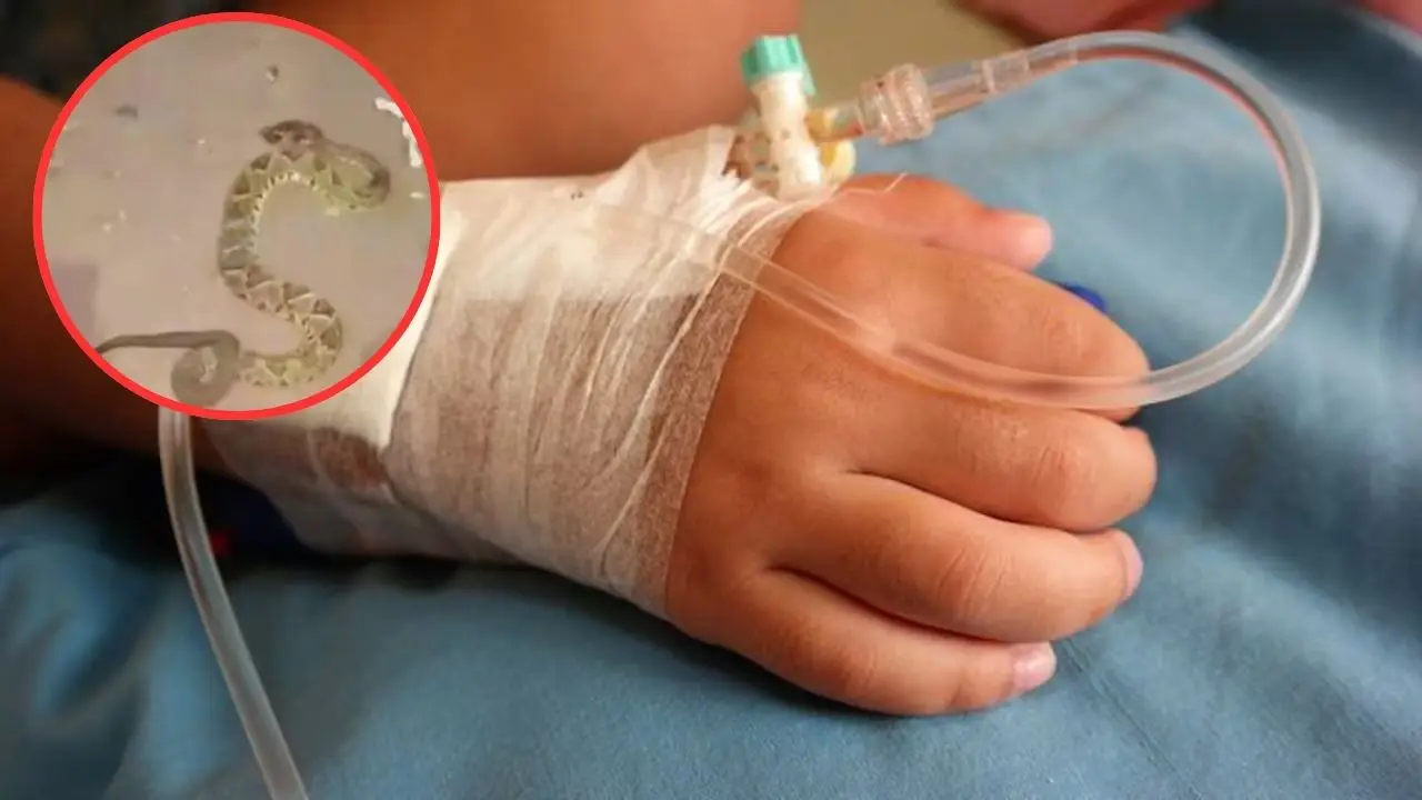Niño de 3 años es hospitalizado tras sufrir mordedura de serpiente cascabel Imagen de Niño de 3 años es hospitalizado tras sufrir mordedura de serpiente cascabel