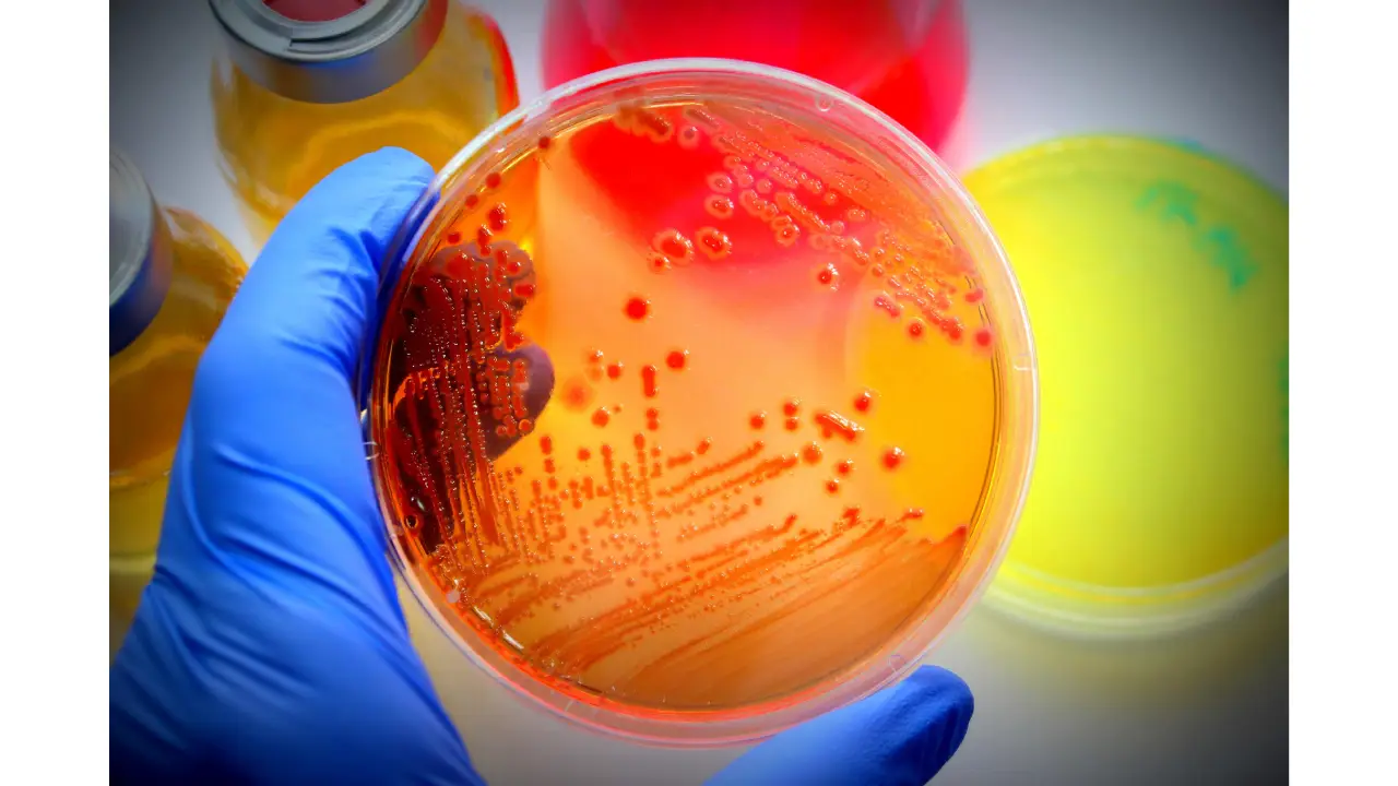 Imagen de referencia de bacteria Escherichia coli.