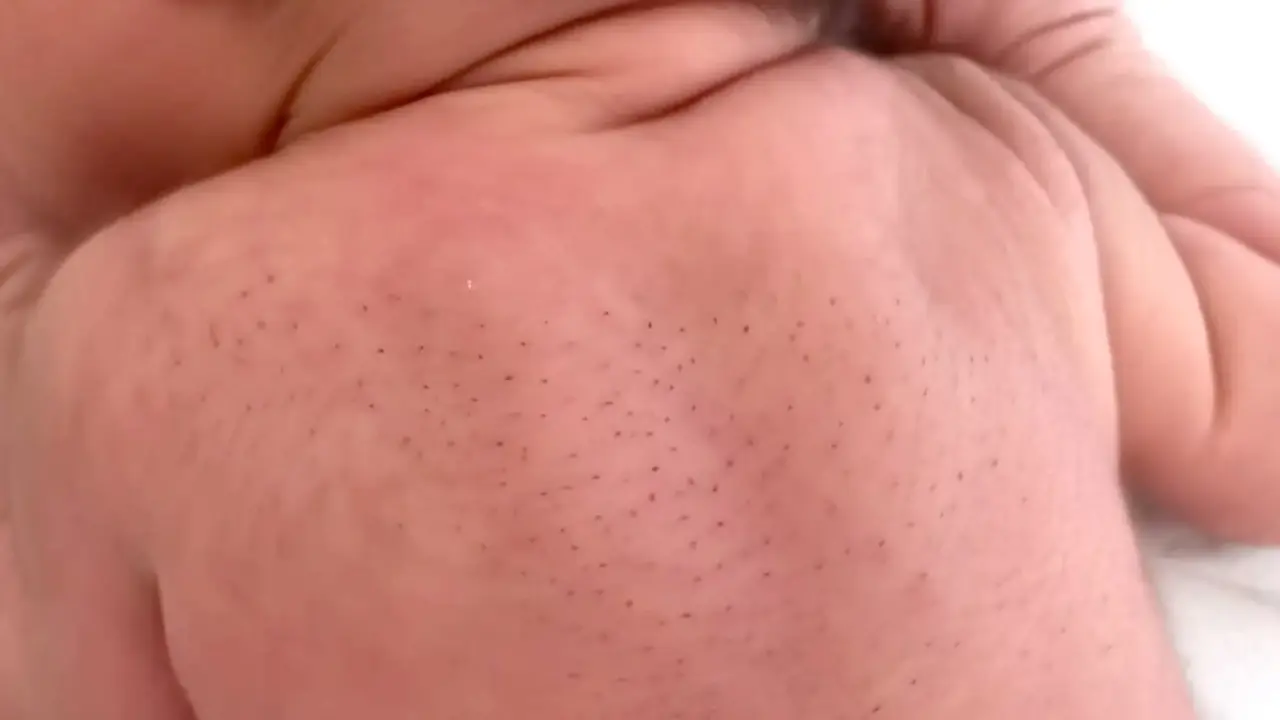 Pediatra explica qué son los 'culucos' y advierte sobre los riesgos de intentar sacarlos Imagen de Pediatra explica qué son los 'culucos' y advierte sobre los riesgos de intentar sacarlos