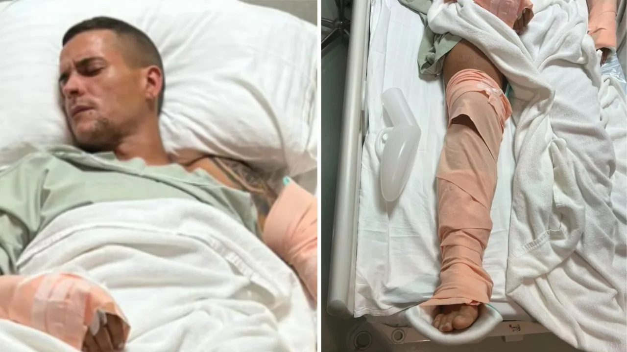 Marc Campo, accidente: ¿Qué le pasó y cuál es su condición actual? Imagen de Marc Campo, accidente: ¿Qué le pasó y cuál es su condición actual?