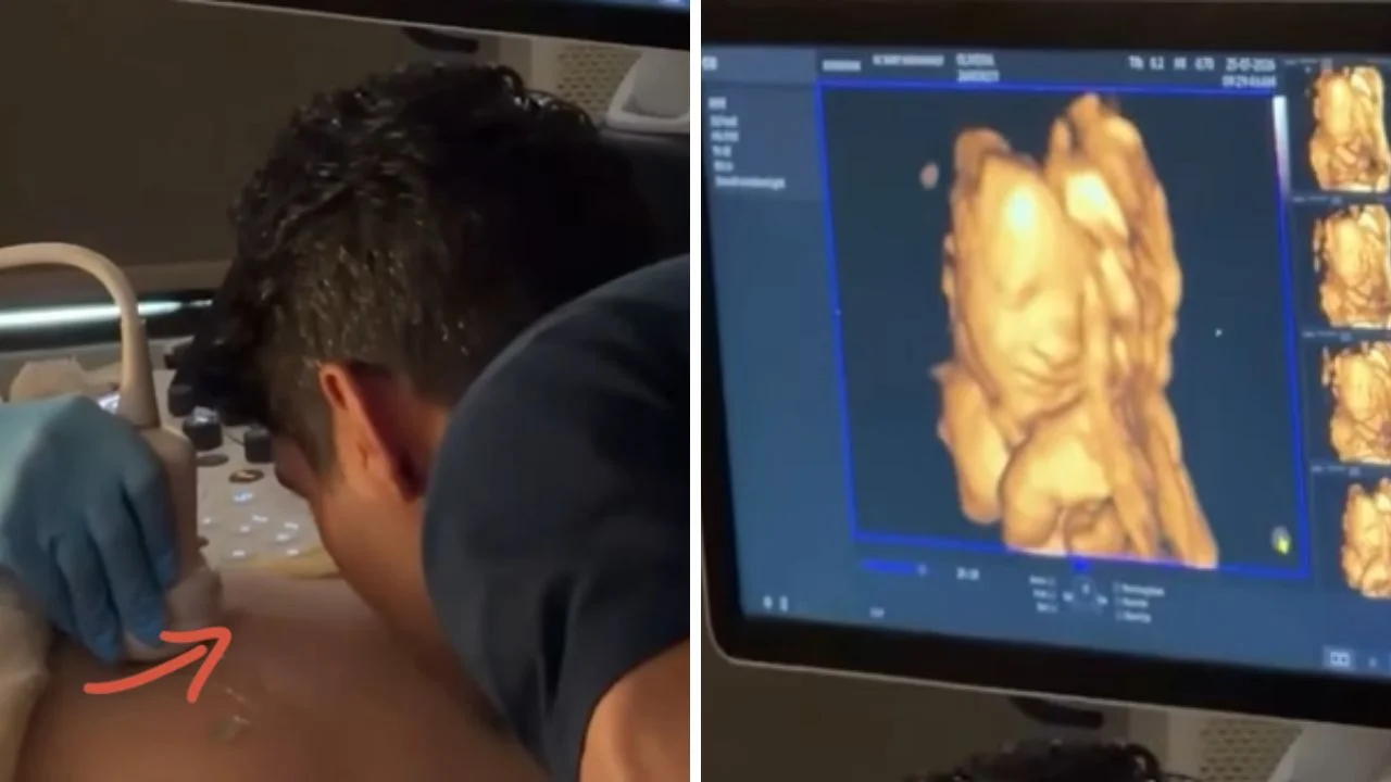 ¡Increíble! Bebé reacciona a caricias desde el vientre de su madre Imagen de ¡Increíble! Bebé reacciona a caricias desde el vientre de su madre