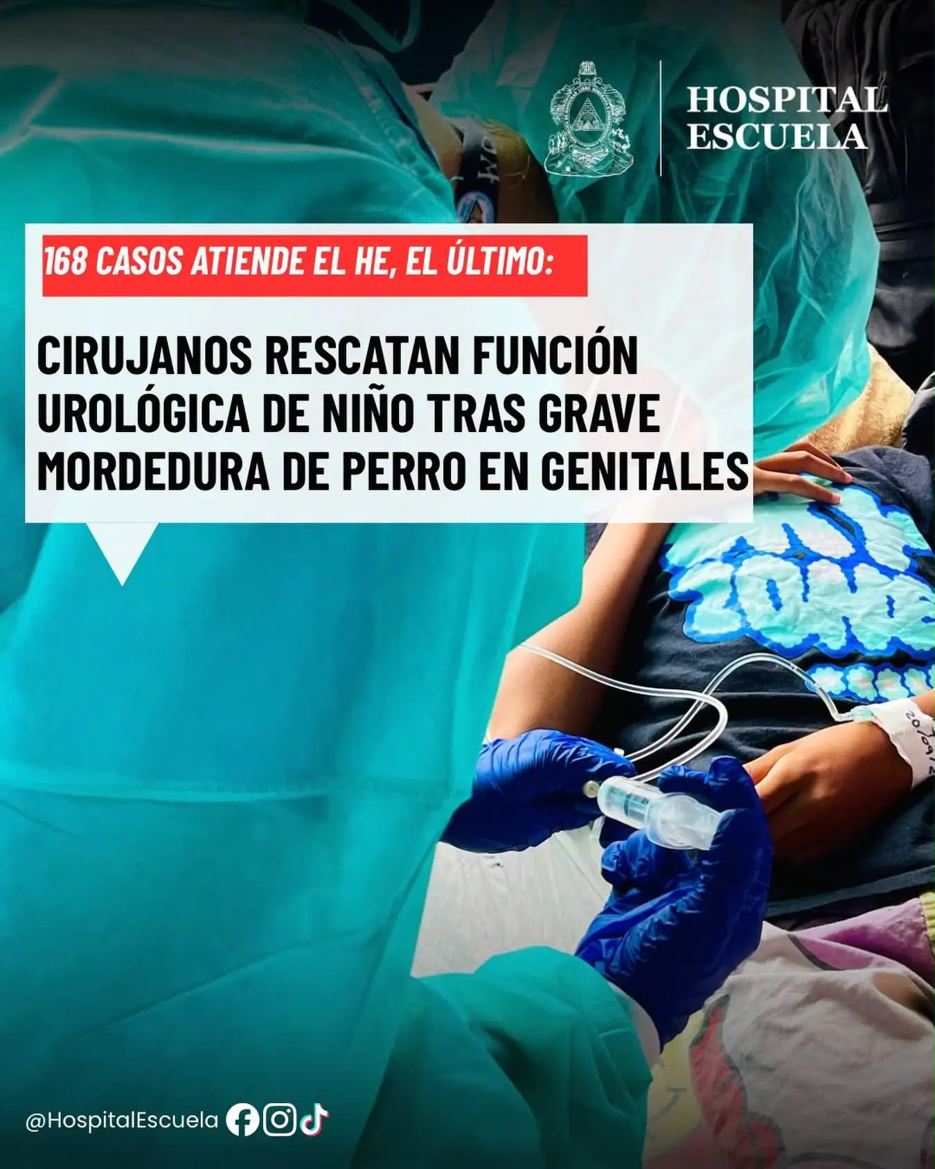 Hospital Escuela opera a menor que sufrió ataque de perro en Tegucigalpa