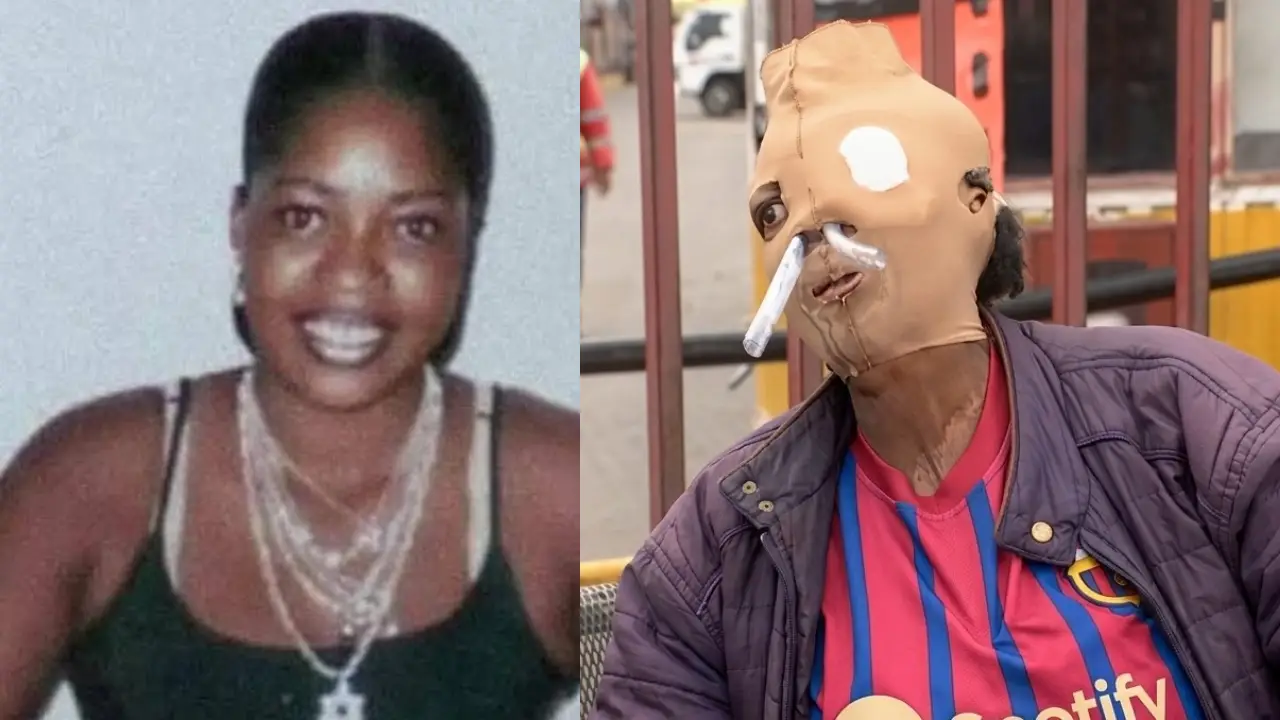 Atacada con ácido y abandonada por su hija: la mujer que decidió vivir Imagen de Atacada con ácido y abandonada por su hija: la mujer que decidió vivir