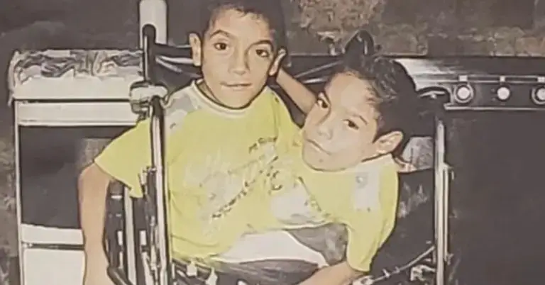 Foto de los hermanos siameses de Ecuador, José Luis y José Armando Cevallos