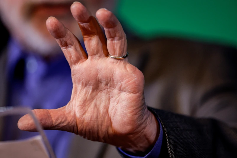 Lula perdió el dedo meñique de la mano izquierda en 1964, cuando trabajaba como tornero mecánico. Foto: cortesía de Infobae