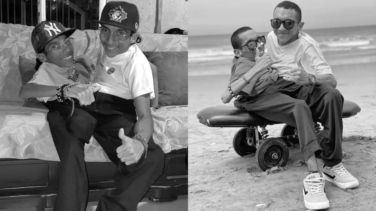 Fallecen los hermanos siameses José Luis y José Armando Cevallos: esto se sabe Imagen de Fallecen los hermanos siameses José Luis y José Armando Cevallos: esto se sabe
