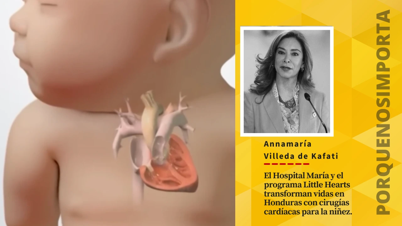 Hospital María transforma la vida de más de 120 niños con cirugías del corazón en el país Imagen de Hospital María transforma la vida de más de 120 niños con cirugías del corazón en el país