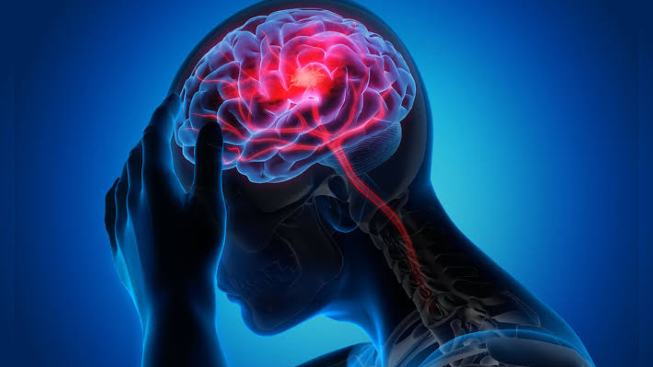 Los cinco hábitos que pueden afectar la salud cerebral, según neurólogo Imagen de Los cinco hábitos que pueden afectar la salud cerebral, según neurólogo